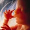 Support the No Taxpayer Funding for Abortion Act Image