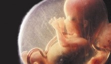 Tell Congress: Stop Socialized Healthcare, Subsidized Abortion